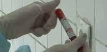 Жители Ревды могут анонимно сдать кровь на ВИЧ 