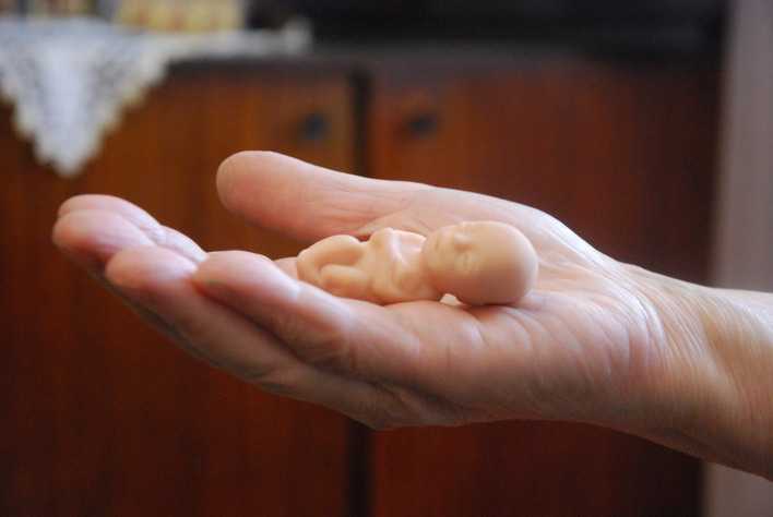 Такой муляж 12-недельного младенца из утробы матери показывают на консультации перед тем, как женщина все-таки решится прервать свою беременность